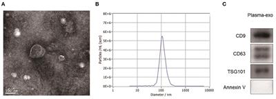 Prognostic Value of Serum Exosomal AHCY Expression in Hepatitis B-Induced Liver Cirrhosis